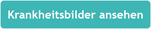 Krankheitsbilder ansehen
